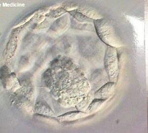 surrogacy embryo