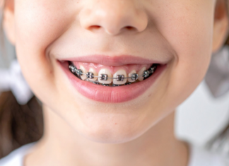 Smiling child wearing braces